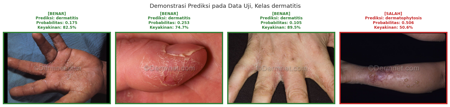 Four dermatitis test-set photos with the model's prediction, probability and confidence; three correct and one wrong