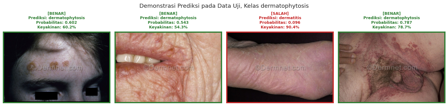 Four dermatophytosis test-set photos with the model's prediction, probability and confidence; three correct and one wrong