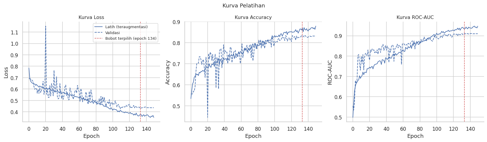 Loss, accuracy and ROC-AUC curves across 150 training epochs for the training and validation sets, with the selected epoch marked at 134